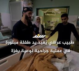 طبيب عراقي يُعيد يد طفلة مبتورة في عملية جراحية نوعية بغزة